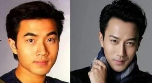 娱乐圈吃瓜爆料男星整容,男星整容风波，真相背后竟是这样...